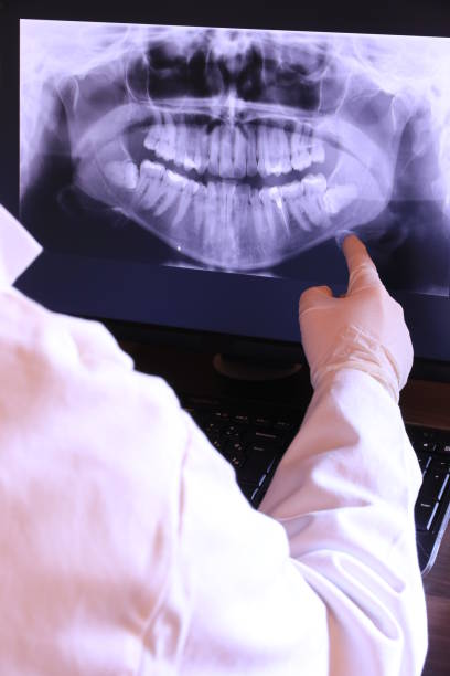 Best Emergency Dental Care for Broken or Chipped Teeth in Llington, MI