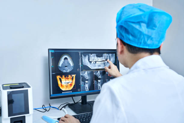 Best Emergency Wisdom Teeth Removal in Llington, MI